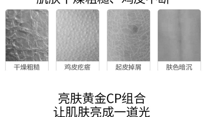 广州身体乳oem/odm代加工厂-烟酰胺美肤身体乳-保湿补水去鸡皮