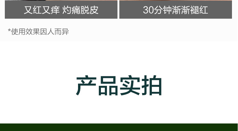芦荟胶祛痘代加工厂-补水保湿收缩毛孔控油祛痘印芦荟凝胶 