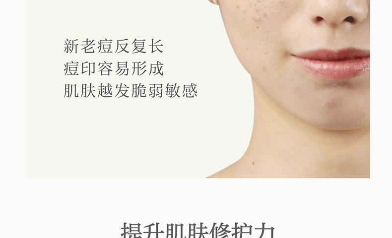 寡肽肌肤修护原液淡化痘印-广东祛痘修复精华代加工厂家